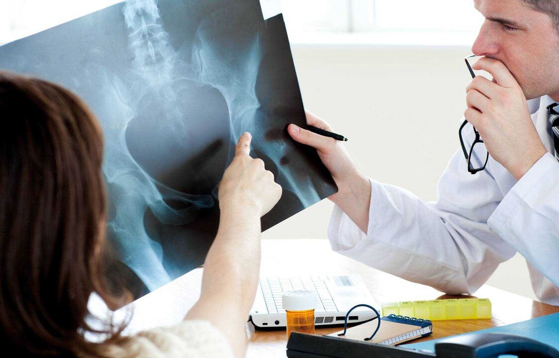 doctors examining x-rays for hip osteoarthritis